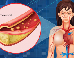 Холестерол - информация, причини за повишени нива и полезни съвети